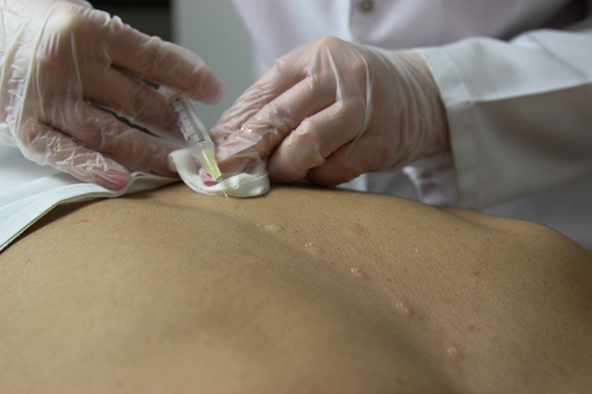 Nöral terapi nedir?